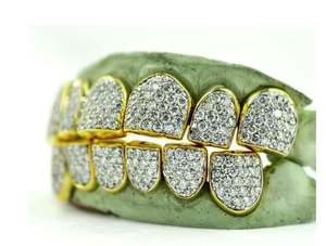 Grillz Personalizados de Color Blanco con Polvo de Diamante y Corte Estilo Hip Hop, Plata de Ley 925, Oro 10K/14K, Joyería de Lujo para Compromiso - Product Image 2