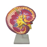 Modèle anatomique de rein humain en métal MAYALAB, couleur personnalisable, outil éducatif scientifique médical de table pour étudiants, structure