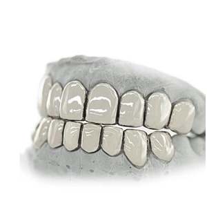 Grillz solide personnalisé 4 pièces, 6 pièces, 8 pièces, 10 pièces en or Grillz en argent, Vermeil, or 10 carats, dents en or 14 carats Grillz - Product Image 4