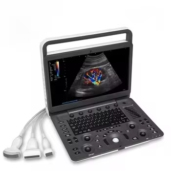 Medical Ultrasound Instruments Ecografia Portatil Sonoscape