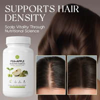 Formule de croissance capillaire à base de plantes Pousse Cheveux Rapide Multi-vitamines pour réduire la chute des cheveux et renforcer la structure capillaire, personnalisable