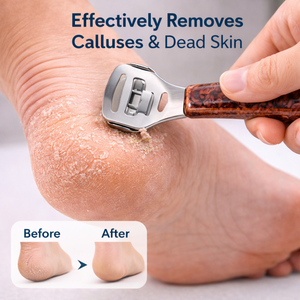 Râpe à pieds ergonomique double face en acier inoxydable pour éliminer les callosités, lime à pédicure, râpe à pieds avec poignée antidérapante, professionnelle et durable - Product Image 6