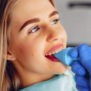 OTICA Écarteur de Bouche et Ouvre-Bouche en Plastique à Double Usage avec Poignée Ergonomique pour la Rééducation et la Thérapie - Product Image 3