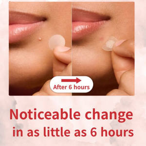 Patch hydrocolloïde coréen pour l'acné, marque privée OEM, vente en gros de soins du visage invisibles et étanches - Product Image 4