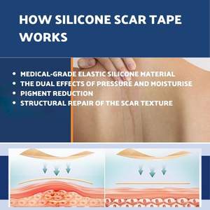 เทปซิลิโคนทางการแพทย์สำหรับรักษารอยแผลเป็น ลดเลือนริ้วรอย กันน้ำ ผลิตตามสั่ง ขายส่ง - Product Image 3