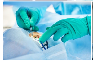 MICROSCOPE CHIRURGICAL 5X15X20 MAGNIFICATION OPHTALMIQUE OEIL MICROSCOPE CHIRURGICAL 3 ÉTAPES SUPPORT DE PLANCHER .... - Product Image 6