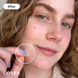 Traitement hydrocolloïde absorbant des taches Couverture d'imperfections à guérison rapide COSRX Patch pour boutons d'acné - Product Image 2