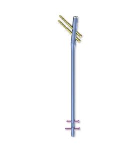 Système d'onglets intramédullaires orthopédiques multifonctionnels en acier inoxydable pour fémur - Product Image 1