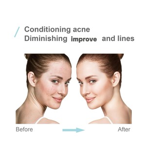 Crème éclaircissante à l'acide lactique et 10% de vitamine A, exfoliant au gel d'aloe vera pour le soin du visage - Product Image 6
