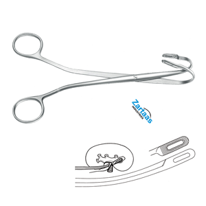 Fórceps de piedra de riñón Randall de acero inoxidable de alta calidad Fig 1, 23cm / 9 "Fabricante y exportador de instrumentos quirúrgicos - Product Image 6