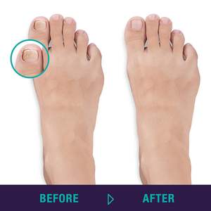 Coupe-ongles pour ongles incarnés et épais 13 cm, lime à ongles en forme de flèche, outils de manucure durables pour peaux mortes, pinces à ongles en métal durable à mâchoires larges - Product Image 6