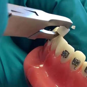 Pince à retirer les adhésifs dentaires, forceps de technologie dentaire, forceps de retrait d'adhésif, forceps orthodontiques par SurgiRight Instrument - Product Image 6