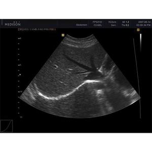 Appareil d'échographie SonoAce X8 avec support OEM/ODM, écran LCD 17 pouces, origine Italie - Product Image 6