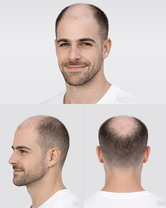 Tupé de <span class=keywords><strong>Cabello</strong></span> Humano Pre-cortado para <span class=keywords><strong>Hombre</strong></span>, Modelo Q6, con Base de Encaje y PU, Sistema de Reemplazo Capilar, Unidades de Parche de Aspecto Natural para Hombres - Product Image 5