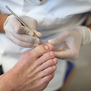 New Toenails Pedicure Treatment Set of 5pcs Chiropody Instruments Nail nippers pean scissors and blade holders Tools OEM by KKZ - Product Image 6