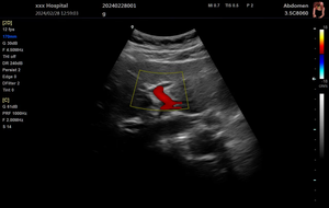 Système d'échographie approuvé <span class=keywords><strong>CE</strong></span>, écran LCD numérique portable de 12 pouces, appareil d'échographie vétérinaire - Product Image 4