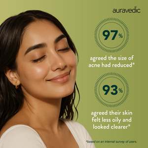 Crema Facial Herbal de 2 Pasos para el Control del Acné, Solución de Doble Etapa para una Piel Clara - Product Image 6