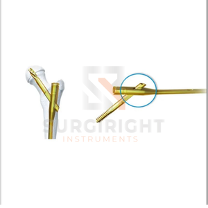 Implantes ortopédicos de trauma entrelazados expertos Clavo tibial suprarrotellante Instrumentos de pedículo de columna vertebral intramedular de Surgiright - Product Image 3