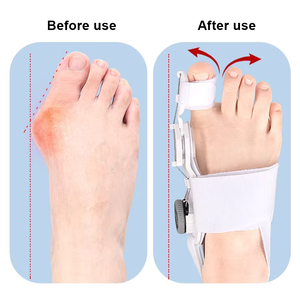 Bouton d'<span class=keywords><strong>orthèse</strong></span> réglable en <span class=keywords><strong>gros</strong></span> <span class=keywords><strong>pour</strong></span> <span class=keywords><strong>gros</strong></span> <span class=keywords><strong>orteil</strong></span> Valgus Fixation séparateur d'<span class=keywords><strong>orteil</strong></span> chevauchant équipement de rééducation de bande <span class=keywords><strong>gros</strong></span> <span class=keywords><strong>orteil</strong></span> - Product Image 6