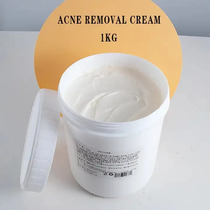 1kg all'ingrosso trattamento a base di erbe lozione per la pelle viso Acne cicatrice brufoli rimozione macchie scure acido salicilico olio dell'albero del tè crema Anti Acne