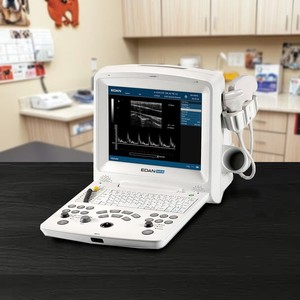 เครื่องอัลตราซาวนด์ดอปเปลอร์แบบพกพาขนาดกะทัดรัด EDAN DUS 60 - Product Image 5