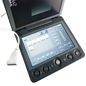 Ecógrafo SonoScape S9 S9V Doppler Color, Máquina de Ultrasonido Portátil, Escáner de Ultrasonido Veterinario - Product Image 2