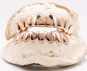Grillz à dents en or massif 10K 14K personnalisé Grillz à coupe permanente fine en argent 925 avec coupe profonde incluse - Product Image 4