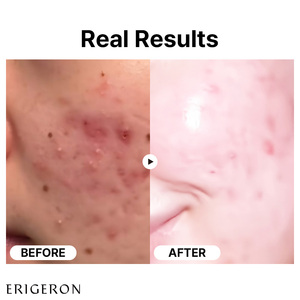 Suero facial ERIGERON con Rosa de niacinamida 20% + 77% para esencia para piel brillante - Product Image 6