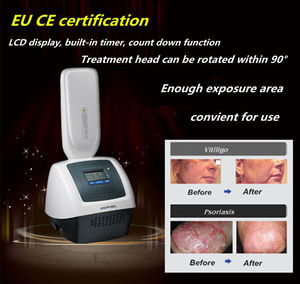 Uso en el hogar Vitiligo Cure Tratamiento Dispositivo médico Láser Vitiligo <span class=keywords><strong>Uvb</strong></span> Lámpara para Psoriasis Terapia de luz en el hogar - Product Image 3