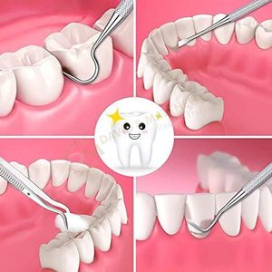 Kit di Strumenti Dentali in Acciaio Inossidabile per Esame e Igiene Orale Manuale - Product Image 5