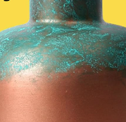 พาทิน่าทองแดง