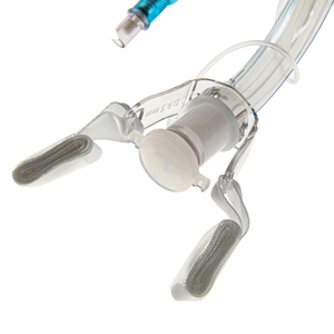 Tabung Trakeostomi Sekali Pakai Canack CE ISO dengan Manset, Kanula Trakeostomi PVC Medis untuk Dewasa, Kanula Dalam Manual Kelas II - Product Image 2