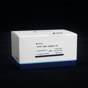 Mẫu Đóng gói 5t ffpe <span class=keywords><strong>DNA</strong></span> cách ly Kit phòng thí nghiệm Thuốc thử cho y tế và bệnh viện phòng thí nghiệm sử dụng <span class=keywords><strong>DNA</strong></span> thanh lọc Kit - Product Image 5