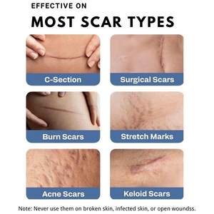 เทปซิลิโคนทางการแพทย์สำหรับรักษารอยแผลเป็น ลดเลือนริ้วรอย กันน้ำ ผลิตตามสั่ง ขายส่ง - Product Image 2