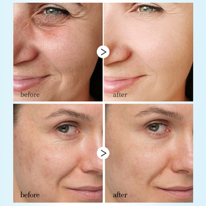 Suero Facial Multifunción 5 en 1 OEM, Niacinamida, Péptido de Cobre Azul GHK-Cu, Suero Reparador Antienvejecimiento - Product Image 4