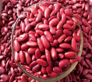 White and Kidney Beans - Product Image 1