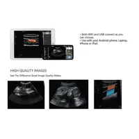 Máquina de Ultrasonido Portátil para Diagnóstico Veterinario con Doble Sonda Convexa/Lineal/Phased Array, Modos de Escaneo para Análisis Portátiles (Modelo