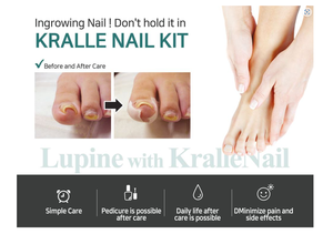 Kralle Krallekit-tratamiento de las uñas de los pies curvo y alivia su dolor grave, cuidado diario para ingrown toenail - Product Image 4
