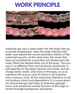 Sistema de Hidroterapia Colónica con Cámara de Observación, Función de Eliminación de Residuos, Limpieza Intestinal, Desintoxicación y Administración de Medicamentos - Product Image 4