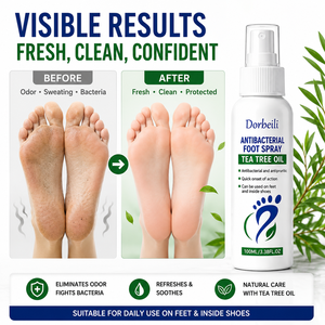 Spray anti-transpirant pour les pieds OEM personnalisé, à base de plantes naturelles, antibactérien, contrôle des odeurs, marque privée, prix direct usine - Product Image 1