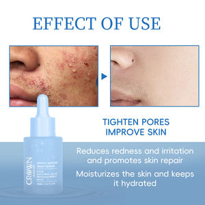 Private Label Vegan Centella Facial Skincare Essência Cica Anti Oxidante Rugas Reparação Clareamento Hidratante Acne Soro Noite - Product Image 3