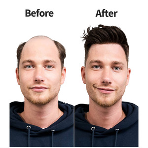 <span class=keywords><strong>N6</strong></span> French Lace Front Perruque de prothèse de cheveux pour hommes en poly PU avec cheveux indiens Toupee européen Couleur naturelle Modèle vierge - Product Image 5