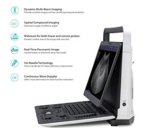 Dispositivo de Ultrasonido de Diagnóstico Portátil Sonoscape E1 E2 E2v Ecocardiógrafo Sonoscape - Product Image 3