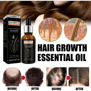 प्राकृतिक शुद्ध बाल देखभाल विकास तेल बायोटिन पुनर्विकास उपचार खोपड़ी के बालों के झड़ने के लिए पतला बाल विकास आवश्यक तेल