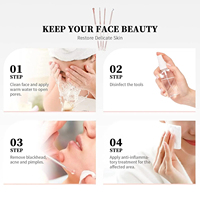 4 pièces aiguilles pour enlever les points noirs d'acné extracteur de taches de bouton en acier inoxydable traitement de l'acné aiguille pour le visage outil de soin propre