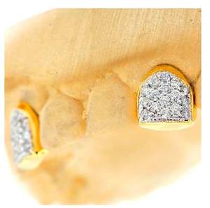 Ajuste personalizado grillz 2 dientes con colmillos de Grillz de ópalo blanco/925 Silver Slugs Grillz - Product Image 2