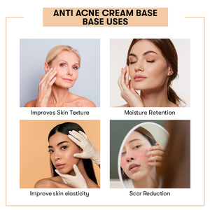 Crema de prevención de cicatrices a base de flores para base de crema antiacné 100% pura y natural a precio mayorista - Product Image 4