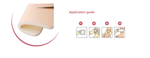 Apósito de espuma para heridas con exudación moderada a abundante, compresas estériles absorbentes de poliuretano - Product Image 6
