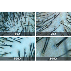 Máy phân tích da đầu và da 3D, camera 400X, đèn AI, Android, cầm tay - Product Image 3