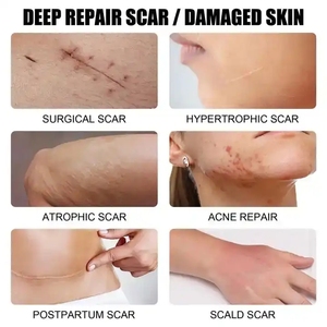 Verwijder Acne Littekencrème Tcm Litteken En Acne Litteken Verwijdering Gel Zalf <span class=keywords><strong>Burn</strong></span> <span class=keywords><strong>Removal</strong></span> Crème Voor Spotbehandelingen - Product Image 4